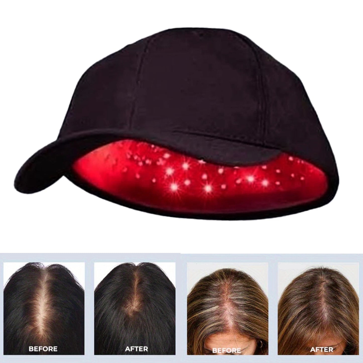 Red Light Therapy Hat - 660nm & 850nm Hair Growth & Regrowth Treatment Cap